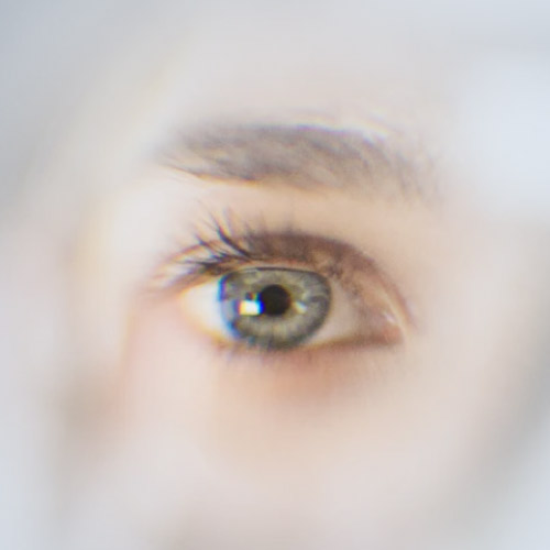 Eye Movement Desensitisation and Reprocessing Therapy (EMDR)